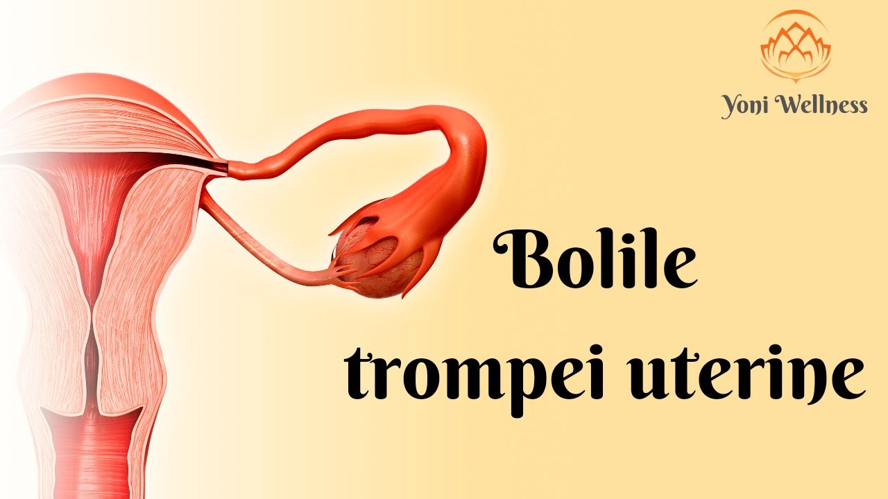 S2. Ep 47 - Bolile trompei uterine | Trompele înfundate | Infertilitate | Hidrosalpinx | Piosalpinx