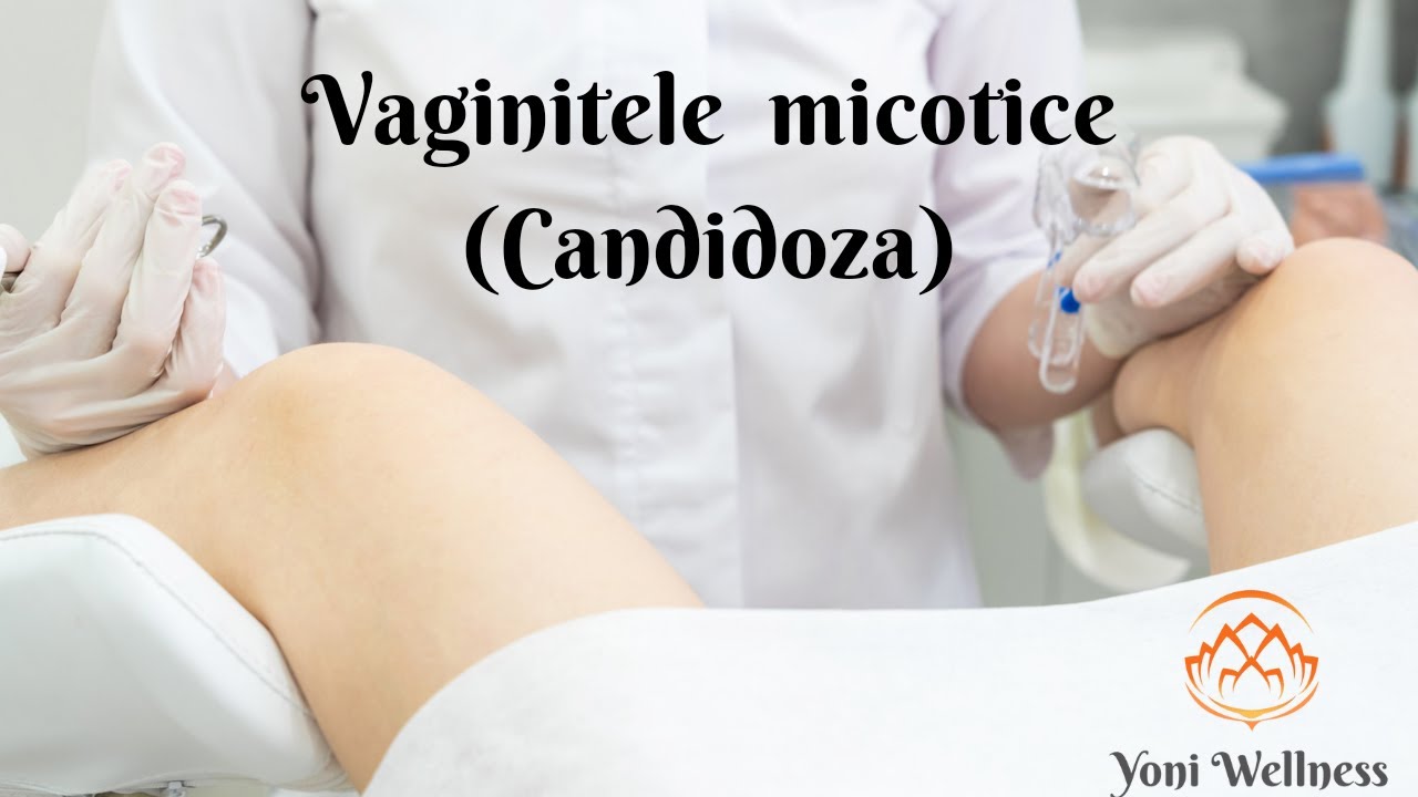 S2. Ep 35 - Candidoza şi alte infecții micotice vaginale | Leucoree | Efecte în sarcină | Tratament