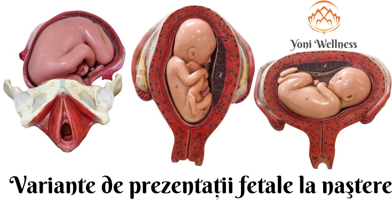 S1.Ep56: Tipuri de prezentații/poziții fetale |Craniană | Pelvină | Trasnsversă |Variante deflectate