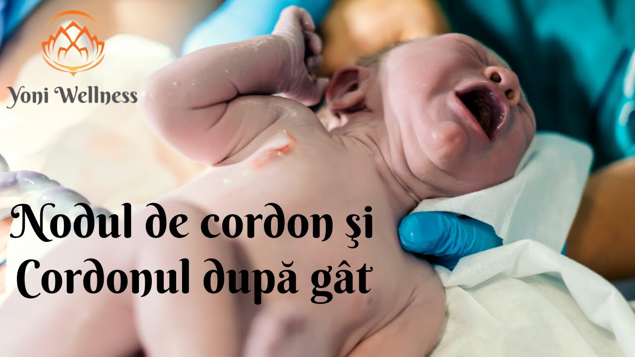 S1.Ep48: Nodul de Cordon | Cordonul după gâtul fetal (Circulara de cordon pericervicală)| Consecințe