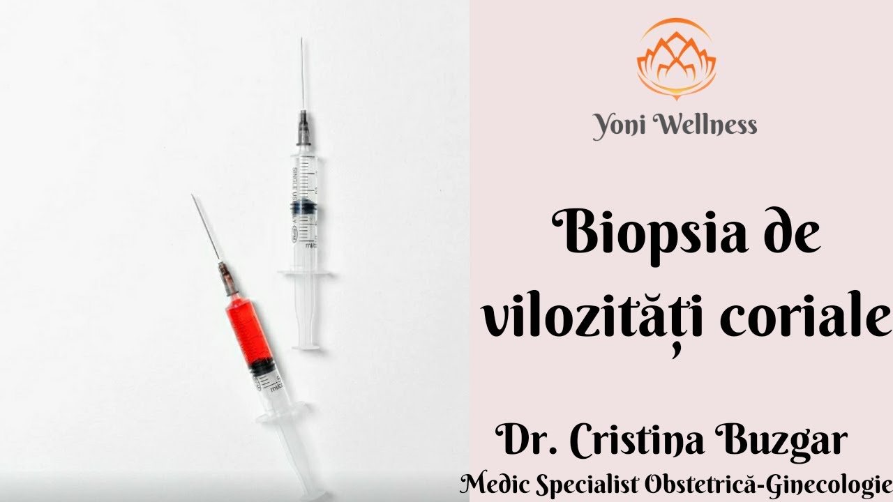 S1.Ep20: Biopsia de vilozități coriale | Test cu acuratețe 100% pentru boli genetice în trimestrul 1